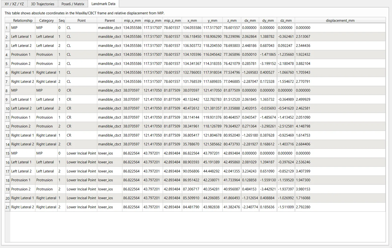 CondyleLocator static relationship report showing landmark coordinates and displacement measurements