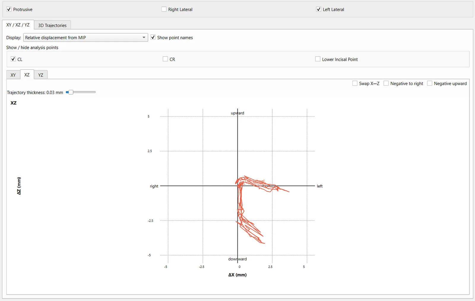CondyleLocator movement scan report showing condylar trajectory traces in an orthogonal projection
